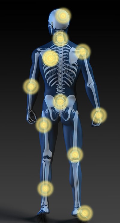 Skeleton with glowing lights showing areas of possible pain.